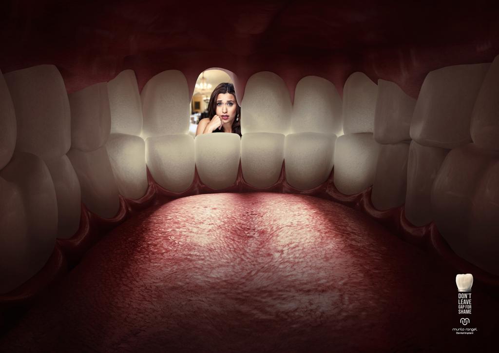 巴西Murilo牙医齿科医院种牙创意平面广告设计-上海广告设计公司广告欣赏1